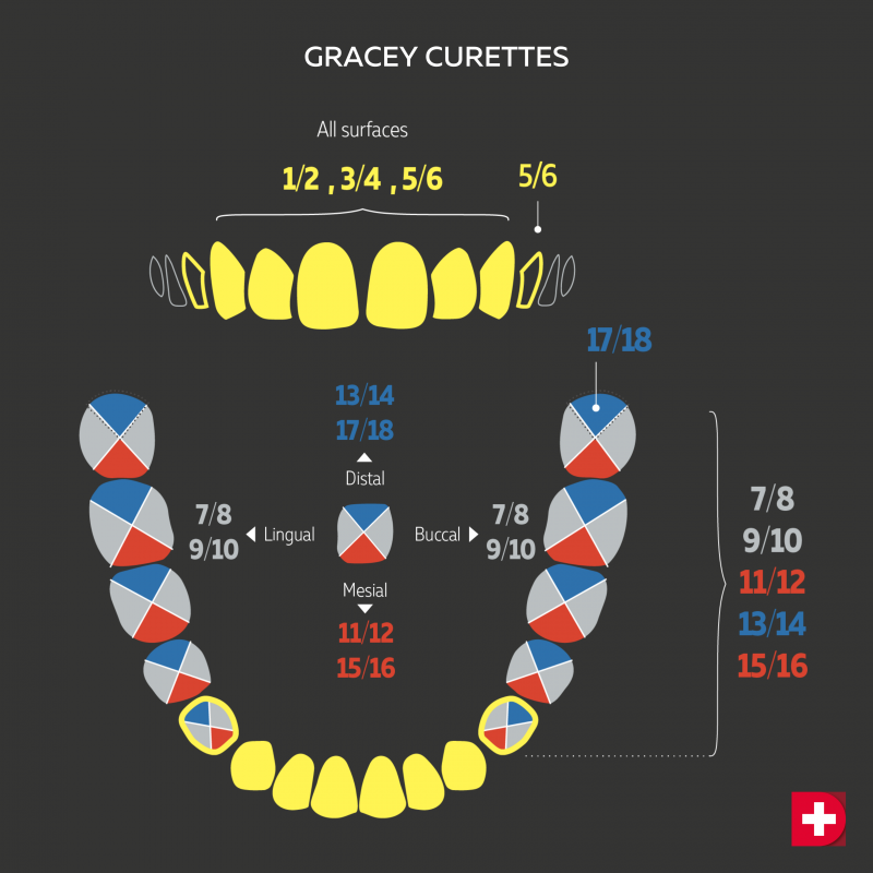 Gracy Curette Guide Size Numbers